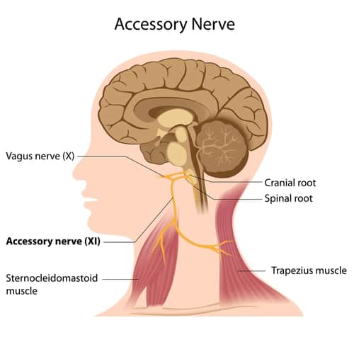 Migraine & Accessory Nerve