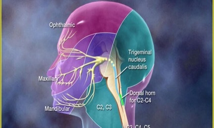 Migraine and neck pain