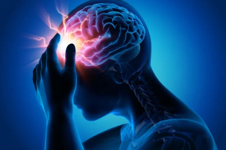 migraine-headache